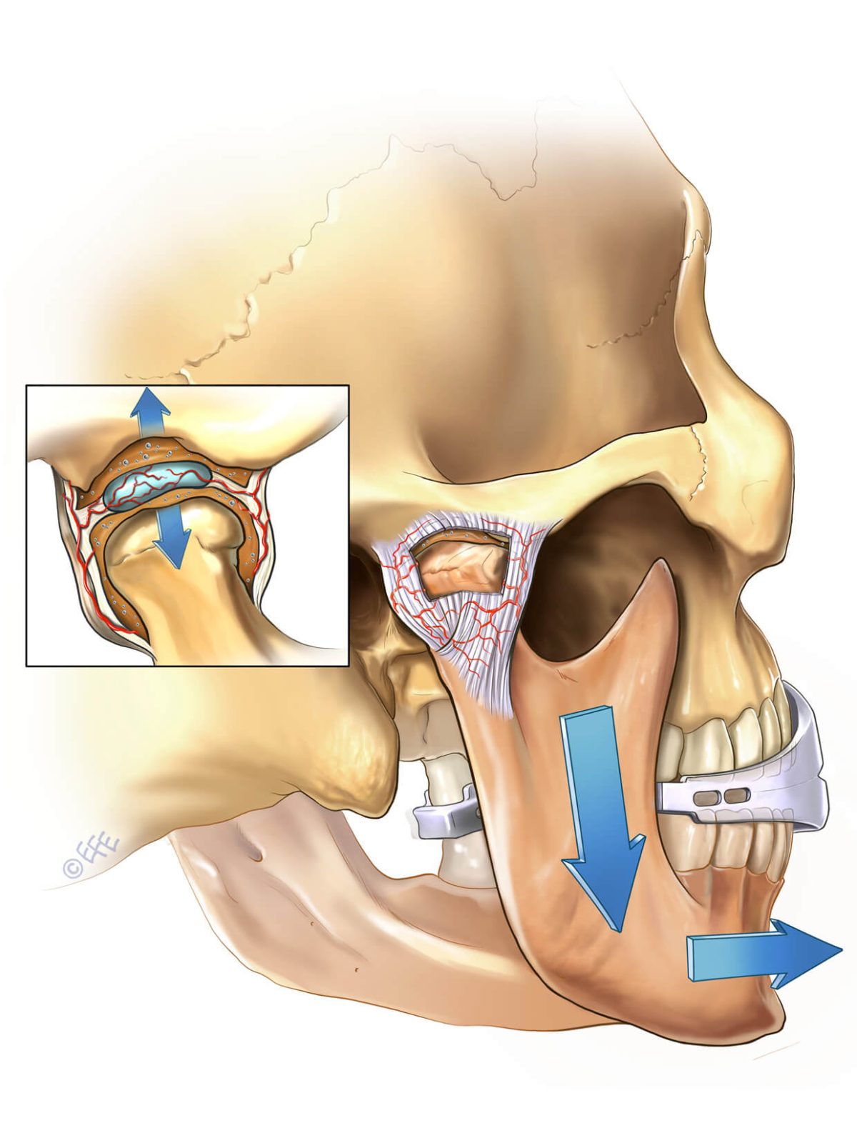 TMJ MOJO Appliance (English) - Image 4